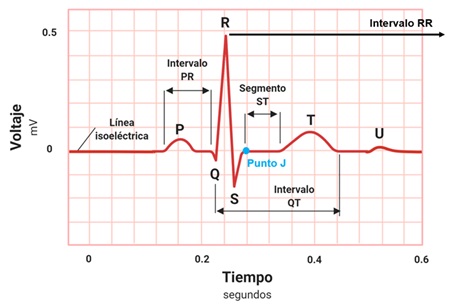 Tentación Abandonar aguacero Taller de interpretación del electrocardiograma. | FISIOLOGÍA